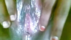 লাইফস্টিনপোইন প্যাক  ...